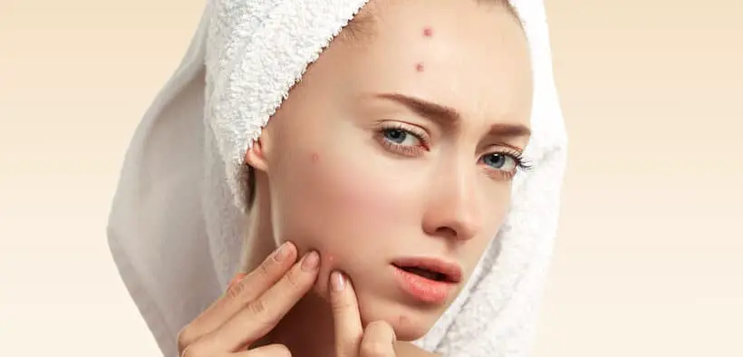 Vitamine-B5-kan-acne-verminderen